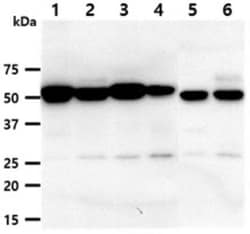 Dkk-3 Mouse anti-Human, Mouse, Clone: 103B5, Novus Biologicals 50uL; Unlabeled:Antibodies,